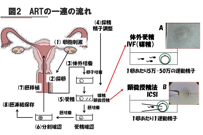 ARTの一連の流れの説明図