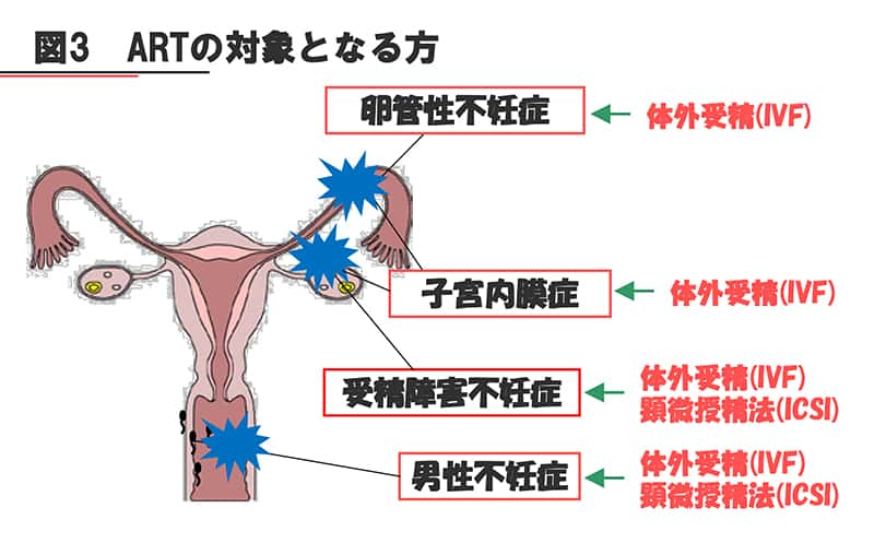 ARTの対象となる方の説明図