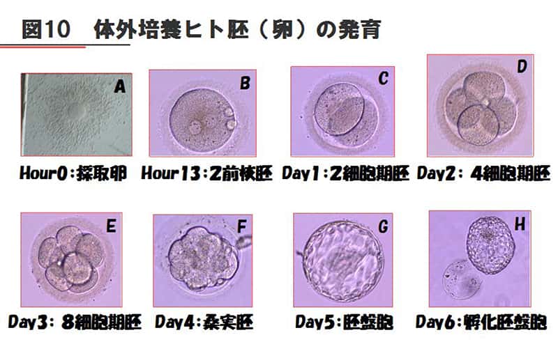 体外培養ヒト胚(卵)の発育を示す写真